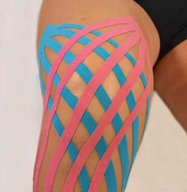 Taping Neuromuscolare