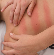 Massaggio Connettivale Reflessogeno